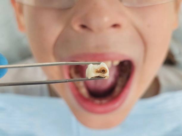 Best Urgent Care for Lost Fillings or Crowns in Chickasha, OK