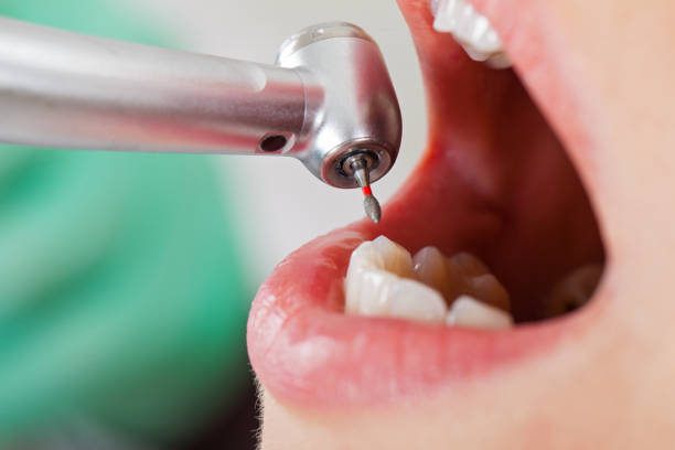 Best Pediatric Emergency Dentist in Chickasha, OK